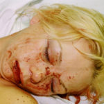 ◆殴られた娼婦の痛々しい写真。事件にならない夜の暴力